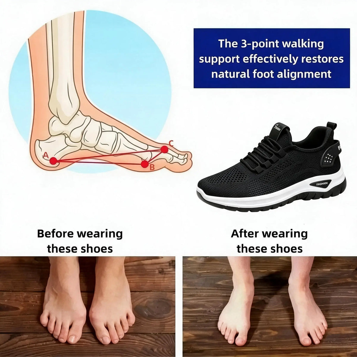 🔥 At Least 50% Off All Products! Orthopedic Women's Shoes with Soft, Cushioned Soles – Comfortable, Pain-Free Walking All Day!